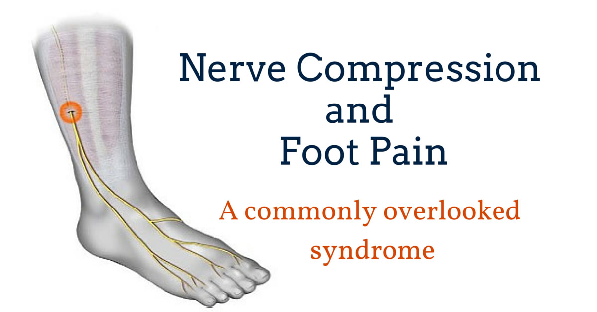 Foot Pain Due To A Nerve Entrapment Gray Chiropractic St Catharines 