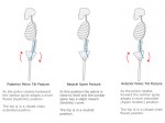 Pelvic Tilt Exercise Tract - Gray Chiropractic St.Catharines Spine ...