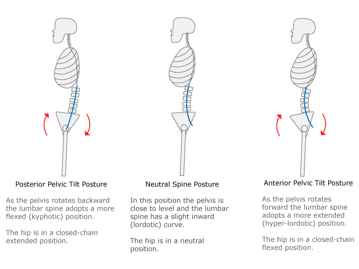 Anterior Pelvic Tilt Transformation