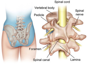 sciatics due to spinal stenosis1